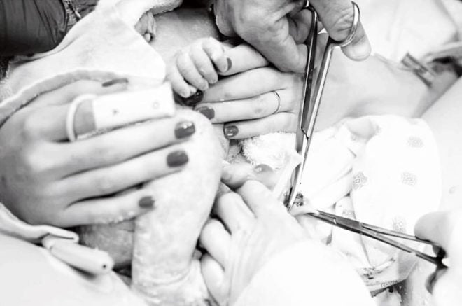 cutting the umbilical cord
